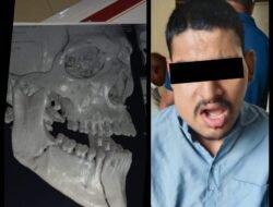 रत्नागिरी : मेंटल हॉस्पिटलमध्ये मतिमंद मुलाला अमानुष मारहाण, वॉर्ड बॉय आणि नर्सने केली मारहाण कुटुंबीयांचा आरोप