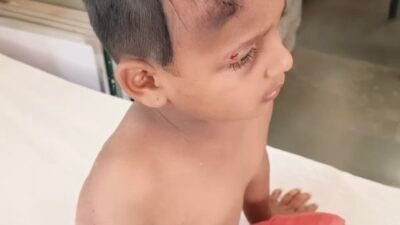 मंडणगडमध्ये मोकाट कुत्र्यांची दहशत; 4 वर्षीय बालकाला चावा, नागरिकांमध्ये भीतीचे वातावरण