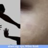 गुहागर : 15 वर्षीय विद्यार्थ्याला शिक्षकाची अमानुष मारहाण, गळा दाबून जमिनीवर आपटल्याचा आरोप, पोलिसांत तक्रार दाखल